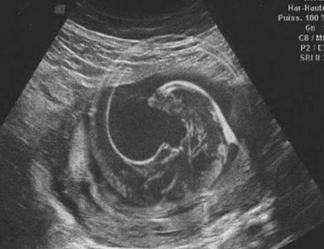 Mujer teme estar embarazada de un 'alien'; supuestamente apareció en ultrasonido
