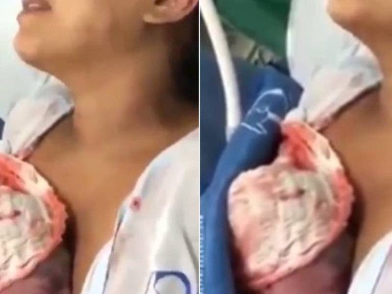 (Video) Bebé ‘resucita’ cuando lo ponen en los brazos de su madre