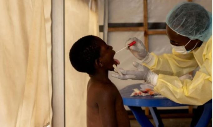 Nueva variante de Mpox: ¿Una amenaza global tras el brote en África?