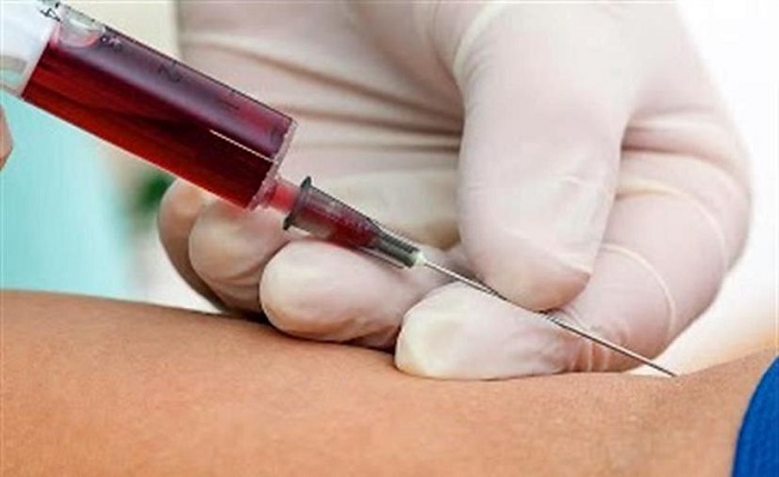 Inician en India pruebas en humanos de vacuna contra Covid-19