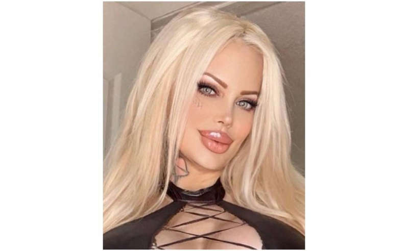 Sabrina Sabrok abusa del bótox y pierde parcialmente la movilidad de su rostro