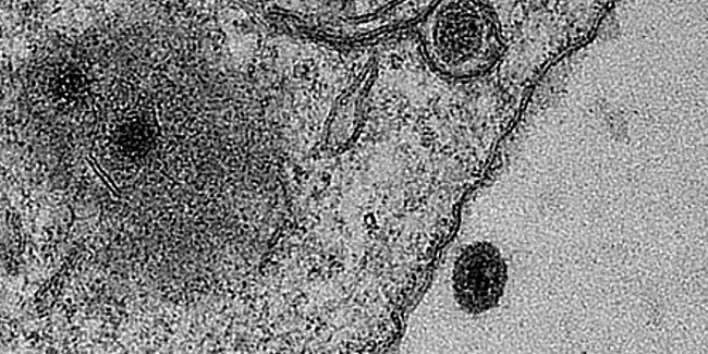 Detectan en Brasil nuevo y misterioso virus nunca antes visto ¡Esto ya es demasiado!