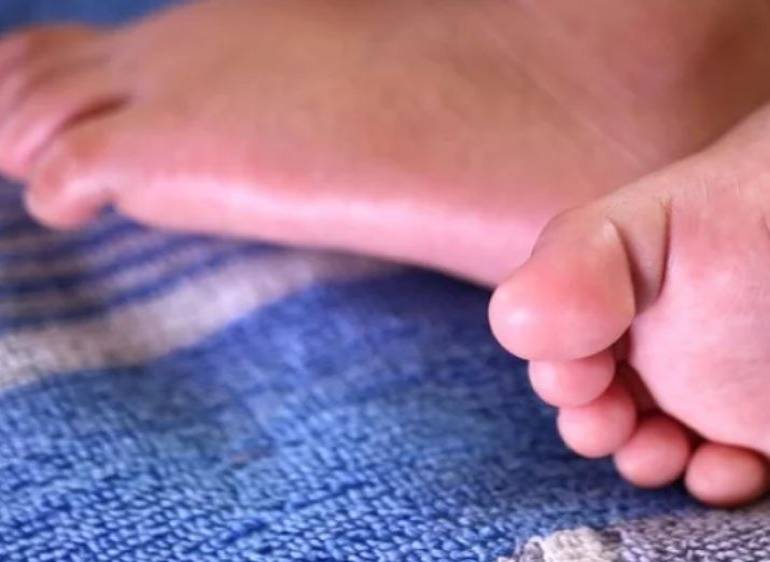 Bangladesh da a luz a gemelos 26 días después de tener su primer hijo