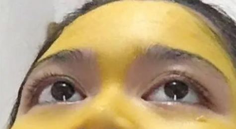 Mujer se pone mascarilla de cúrcuma y su rostro quedó amarillo dos días