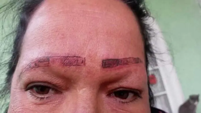 Chihuahua: Joven denuncia a tatuadores por desastre facial contra su madre