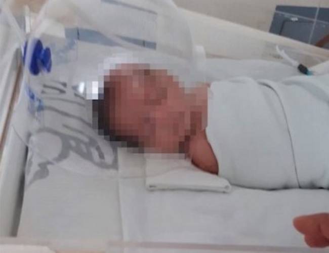 Bebé cae de cunero y sufre fractura de cráneo en hospital del ISSSTE