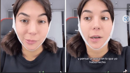 (VÍDEO) Joven impacta en redes al enseñar la parálisis facial que sufrió tras cirugía estética