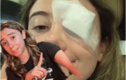 Jovencita acaba en el quirófano por probar un "truco de belleza" en TikTok