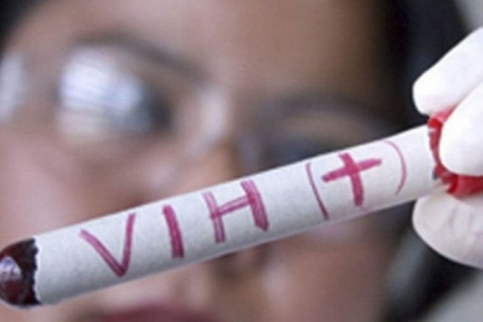 Identifican a pacientes capaces de controlar VIH sin tratamiento