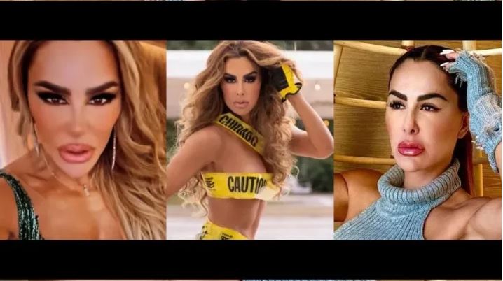 Señalan que Ninel Conde "deformó" su rostro con tantas cirugías